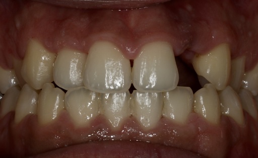 Case 989 before