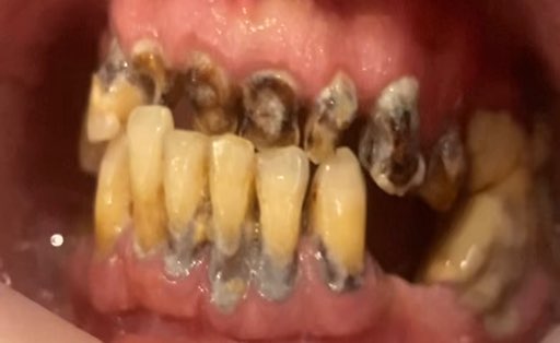 Case 1064 before